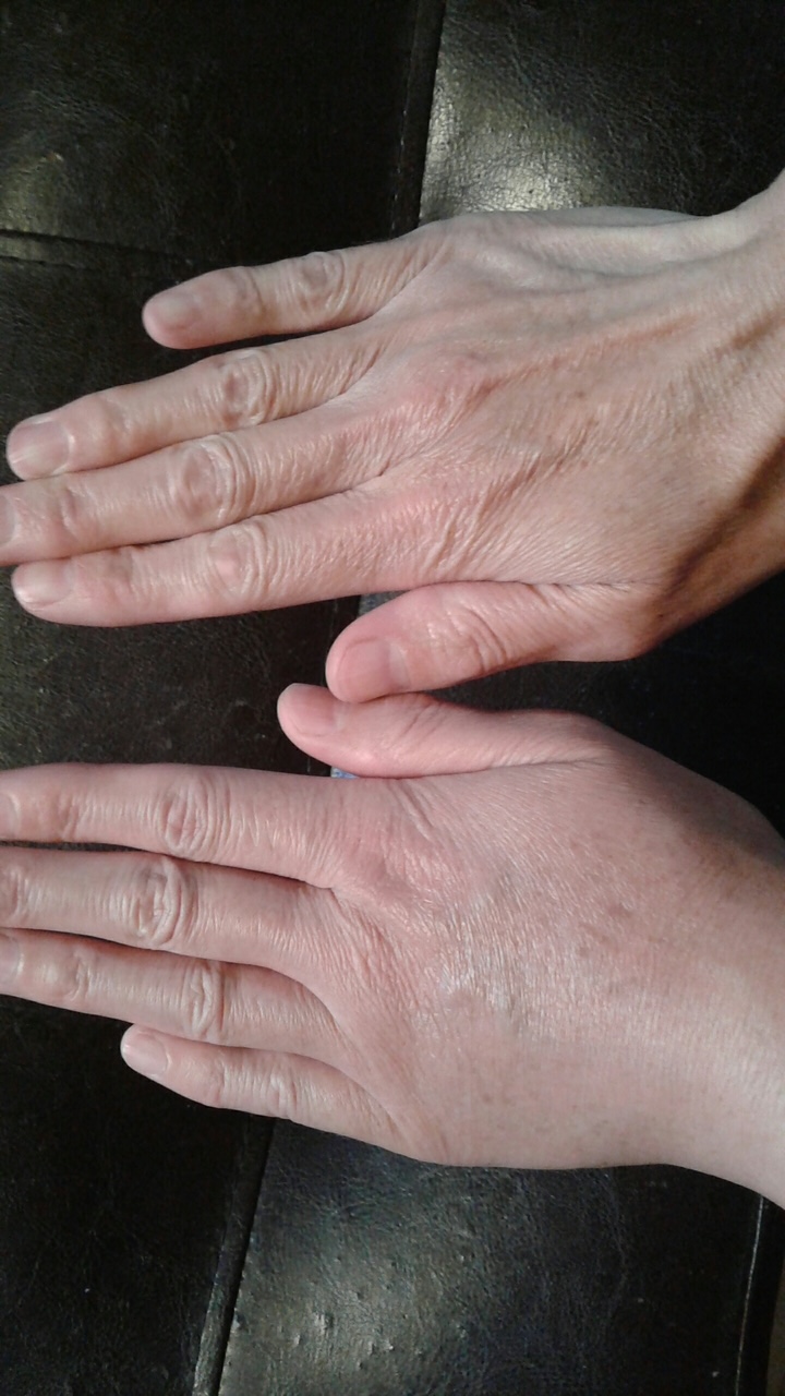 24 Hours After First Session
